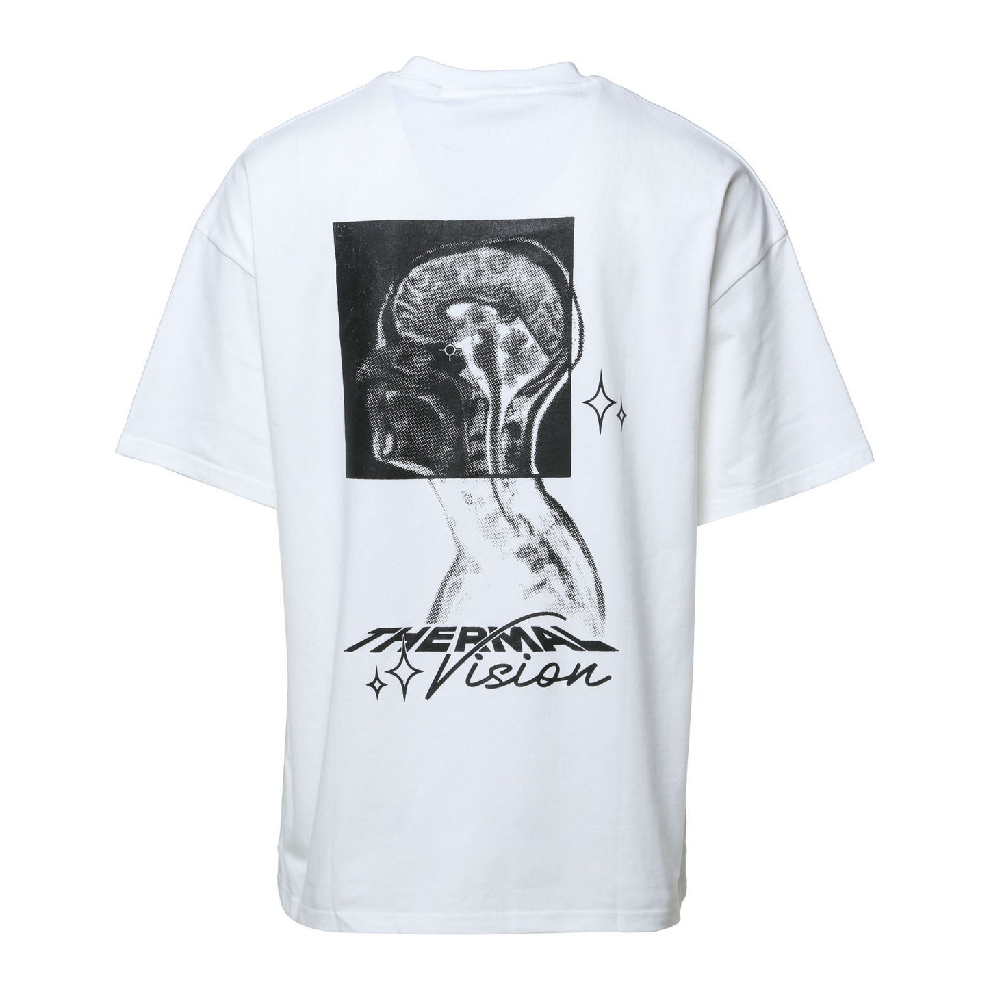 "MRI" Oversized Tee - White